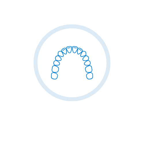 Full arch implants