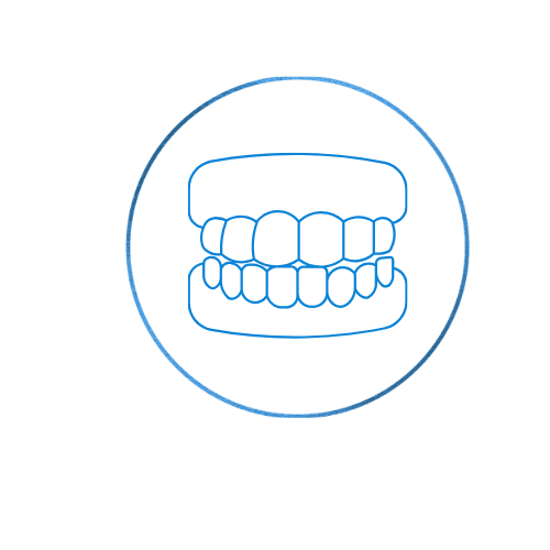 Crooked or Misaligned Teeth