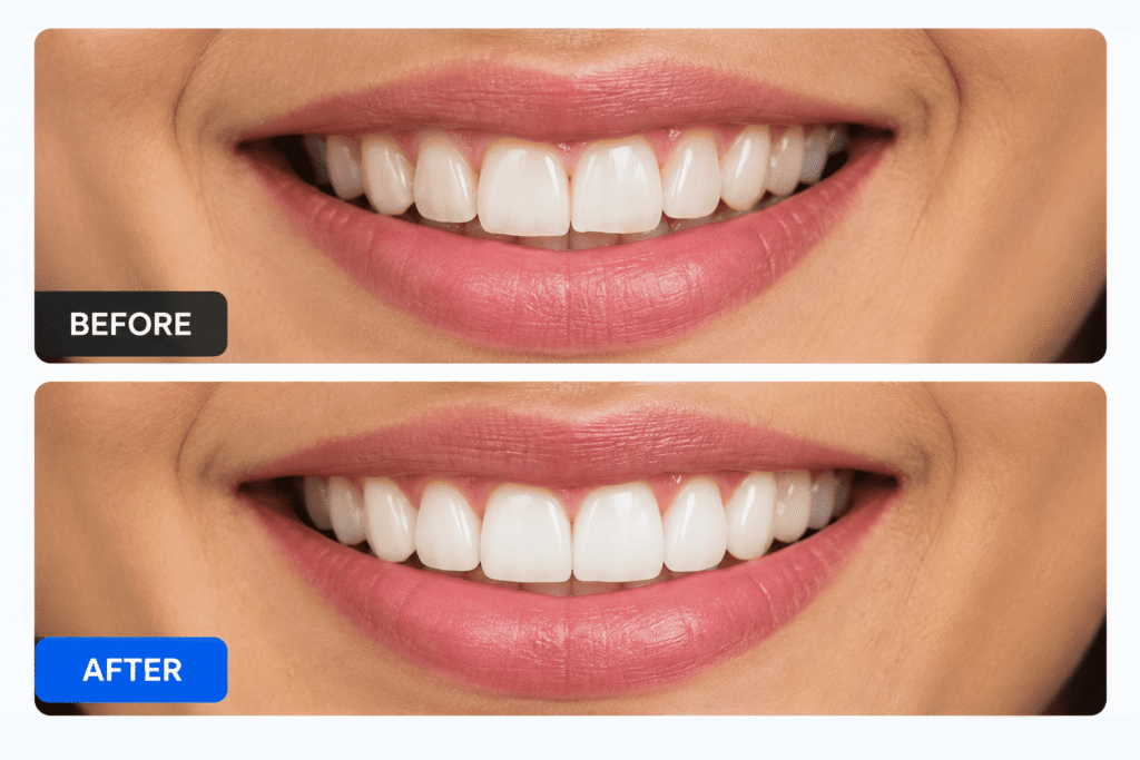 Smile make over in Pm Palem Visakhapatnam