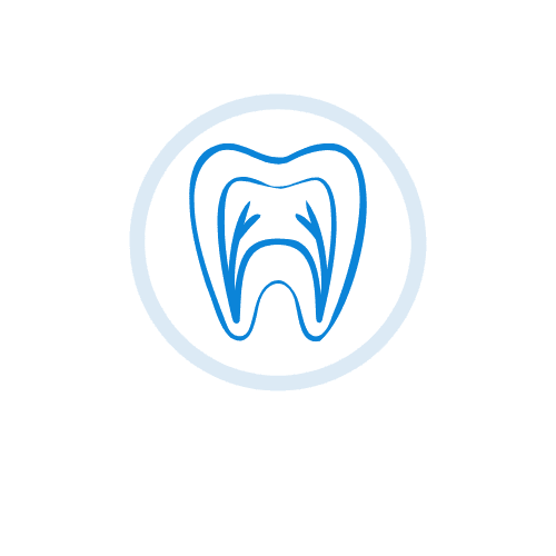 Root Canal Treatment in Visakhapatnam